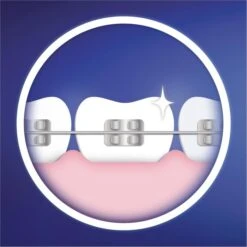 Oral B Oral-B Aufsteckbürsten Ortho Care Essentials, Für Zahnspangen, Weiß, 3 Stück 12 Oral B Oral-B Aufsteckbürsten Ortho Care Essentials, Für Zahnspangen, Weiß, 3 Stück -Tork Shop 7103bdfbef443c306d65968e400f5958fc75361c aufsteckbuersten oral b ortho care essentials