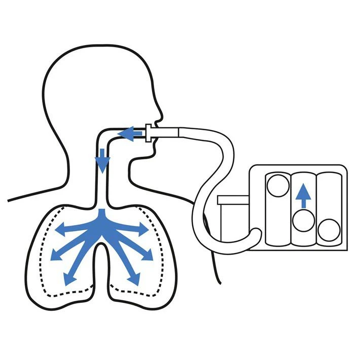 TRI-BALL Atemtrainer, Für Einatmung, Mit 3 Kugeln 2 TRI-BALL Atemtrainer, Für Einatmung, Mit 3 Kugeln – Bild 2