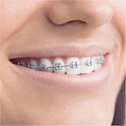 Oral B Oral-B Aufsteckbürsten Ortho Care Essentials, Für Zahnspangen, Weiß, 3 Stück 10 Oral B Oral-B Aufsteckbürsten Ortho Care Essentials, Für Zahnspangen, Weiß, 3 Stück -Tork Shop f9a230f23c2b8574c7b6f8e996984886f18c0da8 aufsteckbuersten oral b ortho care essentials