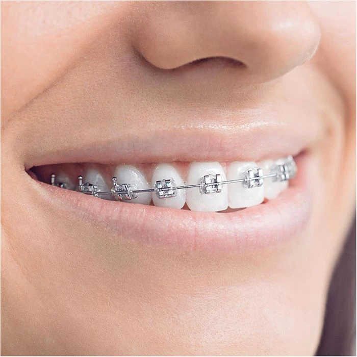 Oral B Oral-B Aufsteckbürsten Ortho Care Essentials, Für Zahnspangen, Weiß, 3 Stück 3 Oral B Oral-B Aufsteckbürsten Ortho Care Essentials, Für Zahnspangen, Weiß, 3 Stück – Bild 3